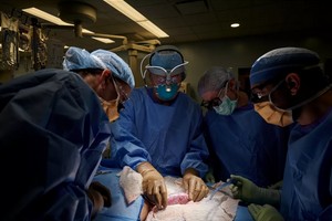 Le rein d'un porc transplanté avec succès sur un humain, une première mondiale